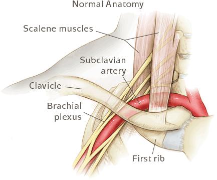 Muscles and Nerve affected by Thoracic Outlet Syndrome